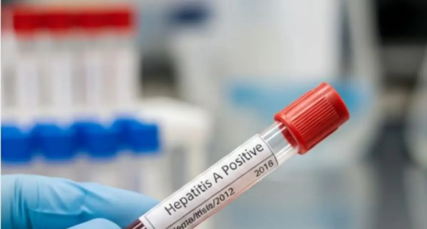 Alerta sanitaria: Se aceleran los casos de Hepatitis A en el pa&iacute;s y detectan la circulaci&oacute;n de un virus poco conocido